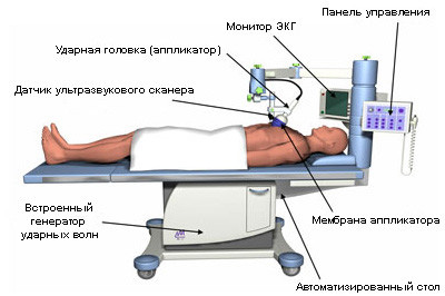 Аппарат Cardiospec для УВТ в Центре Современной Кардиологии