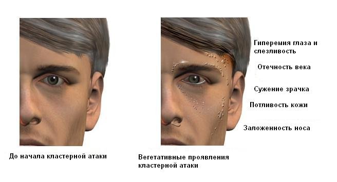 Лечение головной боли неврологом в Центре Современной Кардиологии